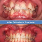 صورة قبل وبعد اجراء التقويم