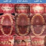 افضل دكتور تقويم اسنان مصر