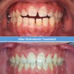 دكتور أحمد مجدي أخصائي تقويم الأسنان