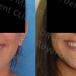 دكتور أحمد مجدي أخصائي تقويم الأسنان