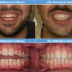 دكتور أحمد مجدي أخصائي تقويم الأسنان