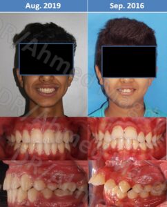 دكتور احمد مجدي- اخصائي تقويم الاسنان