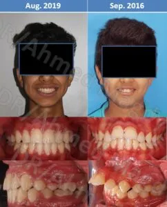 دكتور احمد مجدي- اخصائي تقويم الاسنان