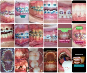 دكتور احمد مجدي - أخصائي تقويم وتجميل الاسنان